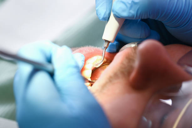 Best Chipped Tooth Repair Near Me  in Kaibito, AZ
